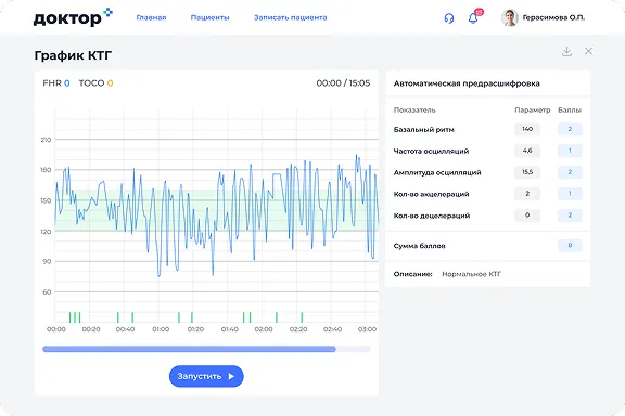 Особенности КТГ